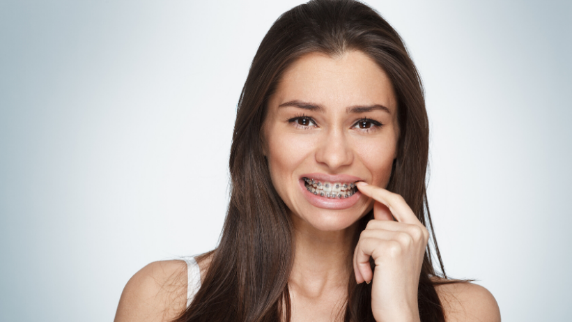 Fiksni aparatić-savjeti-Dentalharmony