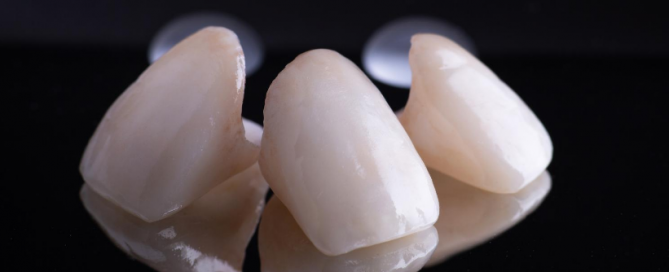 keramičke-krunice-za-zube-dentalharmony