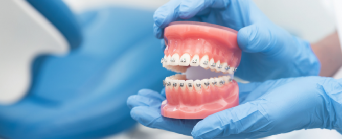 ortodoncija bez vađenja_Dentalharmony