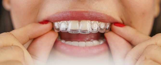 Koja je cijena alajnera?